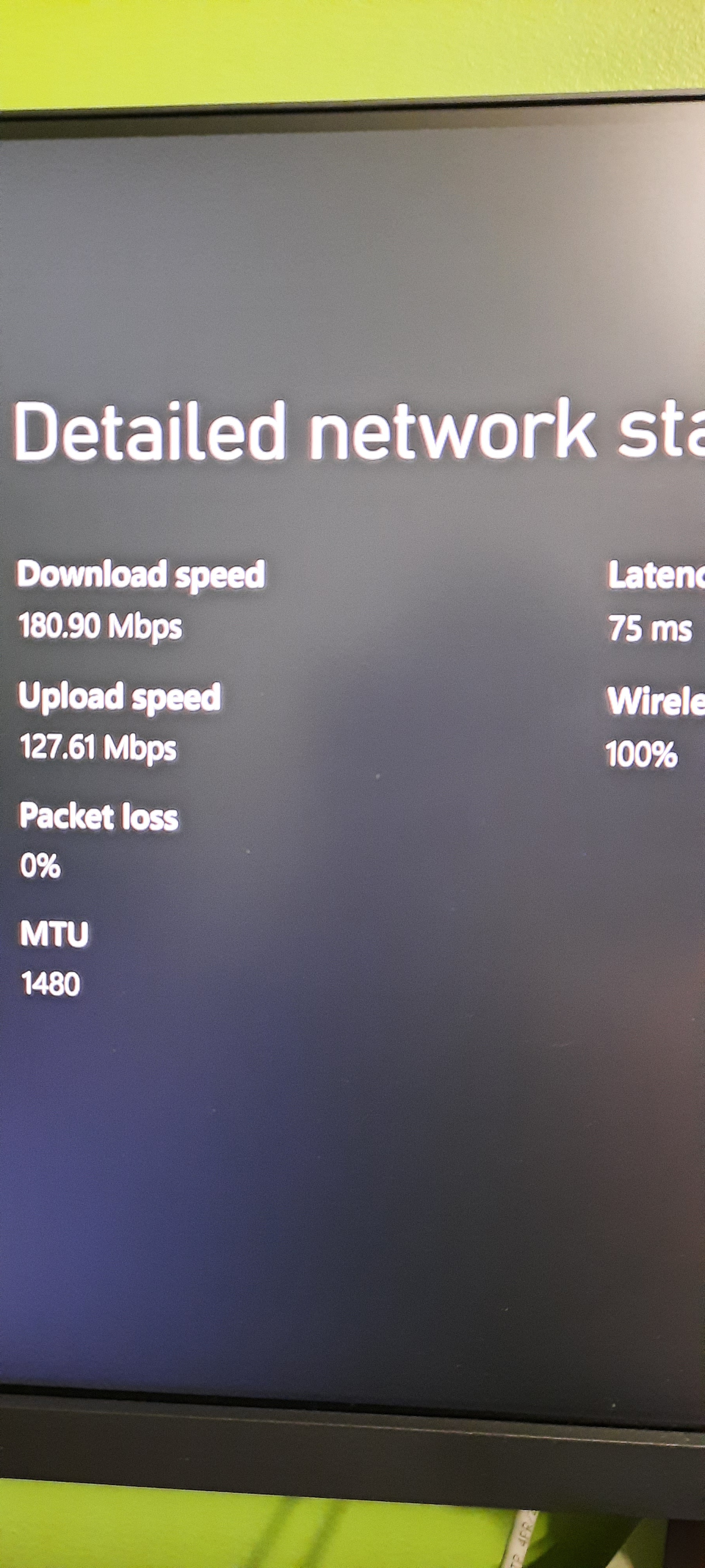 How To Increase Xbox Series S/X Internet Speed, Faster Downloads