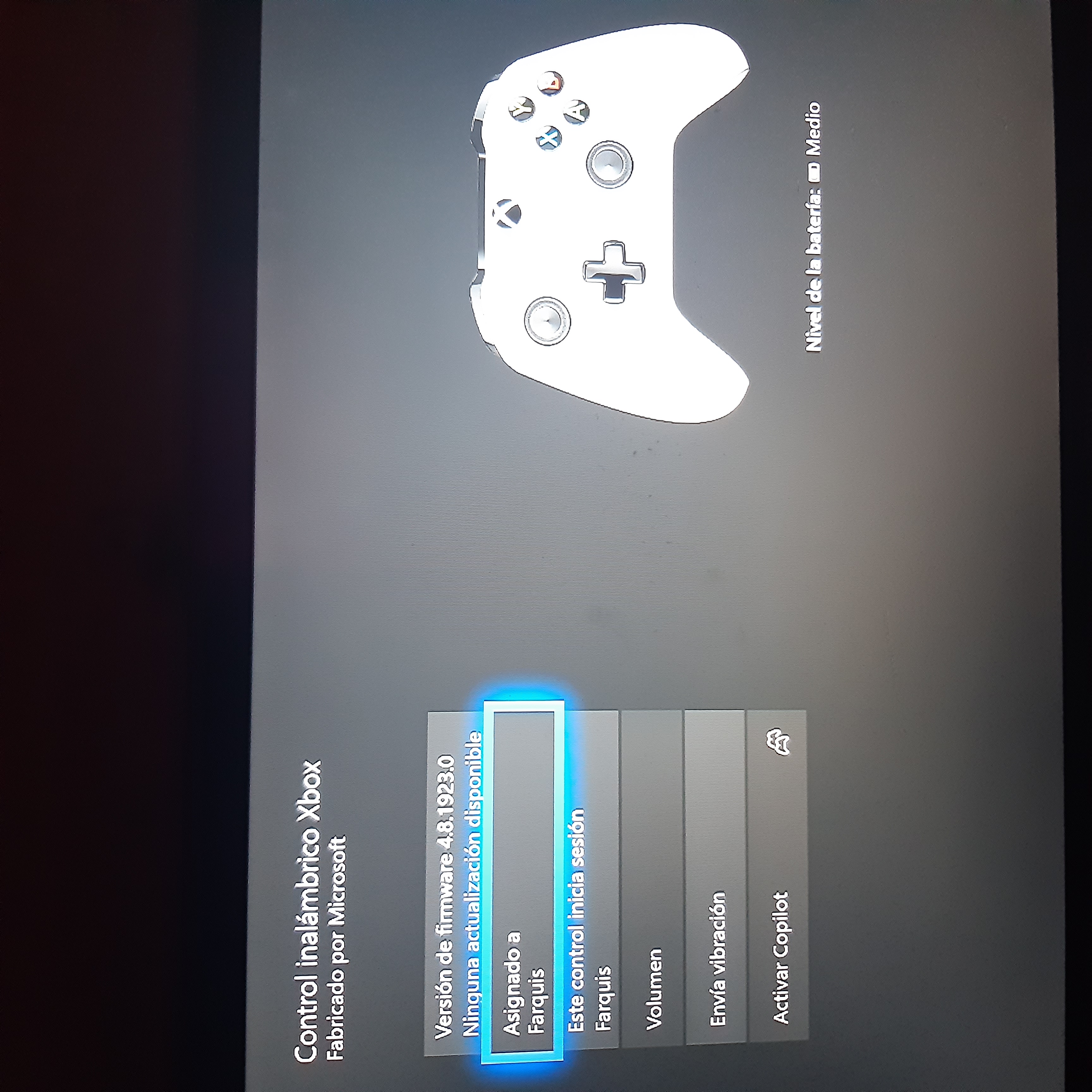 can i stream to my xbox one